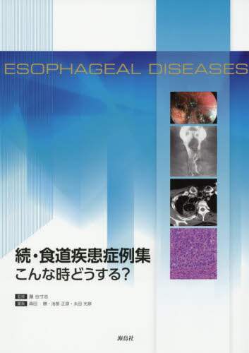 EHǗW 琡u Xc rF