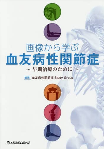 画像から学ぶ血友病性関節症 早期治療のために 血友病性関節症Study Group/編集 メディカルレビュー社