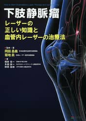 下肢静脈瘤　レーザーの正しい知識と血管内レーザーの治療法