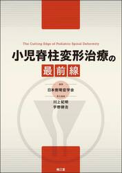 小児脊柱変形治療の最前線