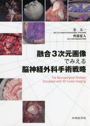 融合３次元画像でみえる脳神経外科手術戦略