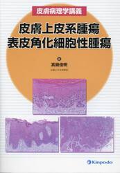 皮膚上皮系腫瘍　表皮角化細胞性腫瘍　皮膚病理学講義