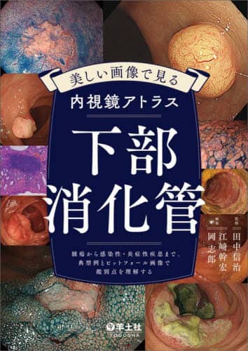 Amazon.co.jp: 内視鏡診断のプロセスと疾患別内視鏡像-上部消化