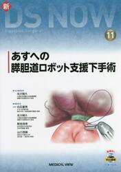 あすへの膵胆道ロボット支援下手術