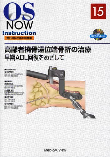 高齢者橈骨遠位端骨折の治療−早期ADL回復をめざして [DVD付