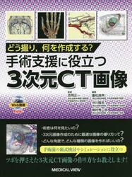 どう撮り，何を作成する？手術支援に役立つ３次元ＣＴ画像