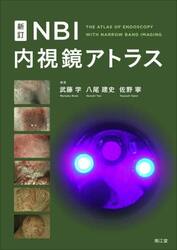 ＮＢＩ内視鏡アトラス