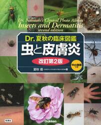 Ｄｒ．夏秋の臨床図鑑虫と皮膚炎
