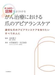 がん治療における爪のアピアランスケア　オールカラー図解でよくわかる　適切な爪のアピアランスケアを知りたいすべての人に