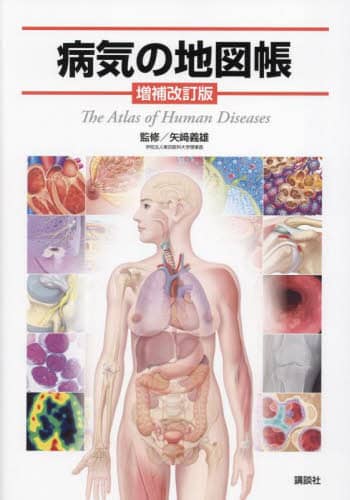 病気の地図帳/矢崎義雄／監修 本 ： オンライン書店e-hon