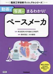 動画と写真でまるわかり！ペースメーカ
