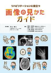 リハビリテーションに役立つ画像の見かたガイド