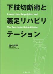 下肢切断術と義足リハビリテーション
