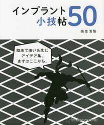 インプラント小技帖５０