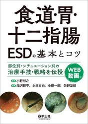 食道・胃・十二指腸ＥＳＤの基本とコツ　部位別・シチュエーション別の治療手技・戦略を伝授