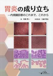 胃炎の成り立ち　内視鏡診断のこれまで、これから