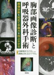 胸部画像診断と呼吸器外科手術　画像診断を究めて手術力を向上させる