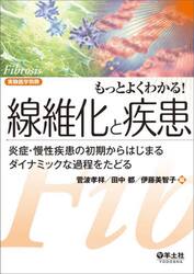 もっとよくわかる！線維化と疾患　炎症・慢性疾患の初期からはじまるダイナミックな過程をたどる