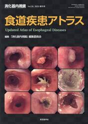 消化器内視鏡　Ｖｏｌ．３５増刊号（２０２３）