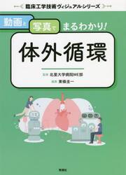 動画と写真でまるわかり！体外循環