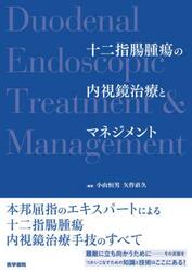 十二指腸腫瘍の内視鏡治療とマネジメント