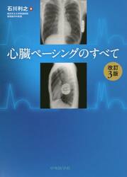 心臓ペーシングのすべて