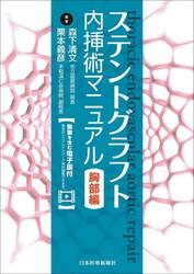 ステントグラフト内挿術マニュアル　胸部編