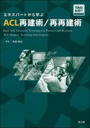 エキスパートから学ぶＡＣＬ再建術／再再建術