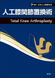 人工膝関節置換術