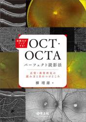 診断力がアップする！ＯＣＴ・ＯＣＴＡパーフェクト読影法　正常・異常所見の読み方と目のつけどころ