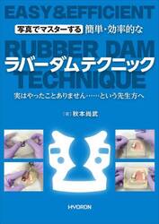 写真でマスターする簡単・効率的なラバーダムテクニック　実はやったことありません……という先生方へ