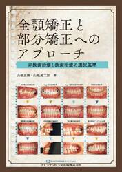 全顎矯正と部分矯正へのアプローチ　非抜歯治療と抜歯治療の選択基準