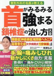 首がみるみる強まる頚椎症の治し方大全　整形外科の名医が教える