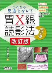 これなら見逃さない！胃Ｘ線読影法虎の巻　シェーマ内視鏡像病理像の比較・対比で納得！