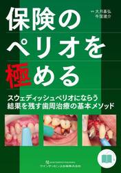 保険のペリオを極める　スウェディッシュペリオにならう結果を残す歯周治療の基本メソッド