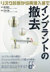 インプラントの撤去　リスク診断から再埋入まで
