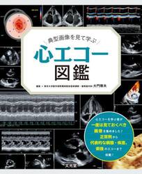 典型画像を見て学ぶ心エコー図鑑