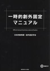 一時的創外固定マニュアル