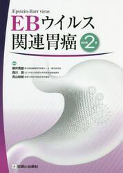 ＥＢウイルス関連胃癌