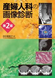 産婦人科の画像診断