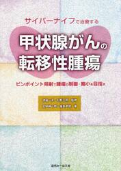 サイバーナイフで治療する甲状腺がんの転移性腫瘍　ピンポイント照射で腫瘍の制御・縮小を目指す