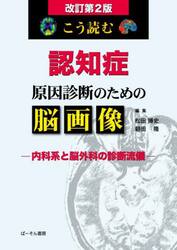 こう読む認知症原因診断のための脳画像　内科系と脳外科の診断流儀