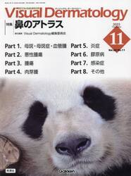 Ｖｉｓｕａｌ　Ｄｅｒｍａｔｏｌｏｇｙ　目でみる皮膚科学　Ｖｏｌ．２２Ｎｏ．１１（２０２３−１１）