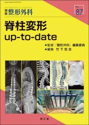 脊柱変形ｕｐ‐ｔｏ‐ｄａｔｅ