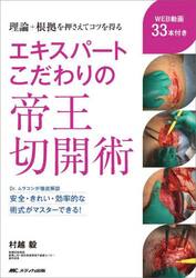 エキスパートこだわりの帝王切開術　理論＋根拠を押さえてコツを得る