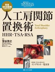 人工肩関節置換術　ＨＨＲ・ＴＳＡ・ＲＳＡ　写真・ＷＥＢ動画で理解が深まる