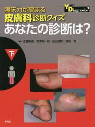 臨床力が高まる皮膚科診断クイズあなたの診断は？　下