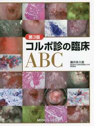 コルポ診の臨床ＡＢＣ