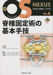 脊椎固定術の基本手技