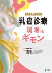 ここが知りたい！乳癌診療現場のギモン